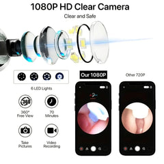 Visual Ear Cleaner – Smart Otoscope with LED Light & Ear Wax Removal Kit